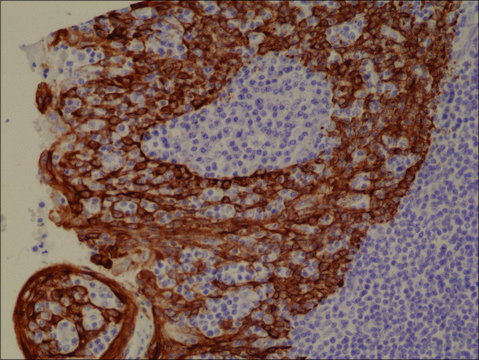 Anti-CK-5/CK-6 (Cytokeratin 5/ Cytokeratin 6)