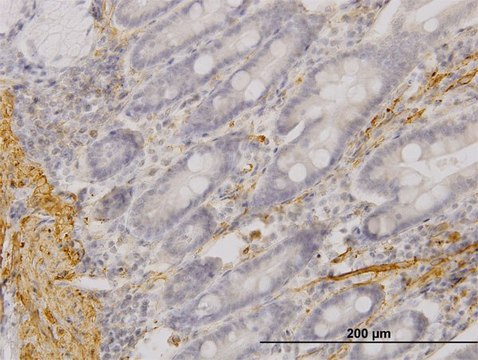 Monoclonal Anti-MYOC antibody produced in
