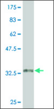 Monoclonal Anti-CARM1 antibody produced in