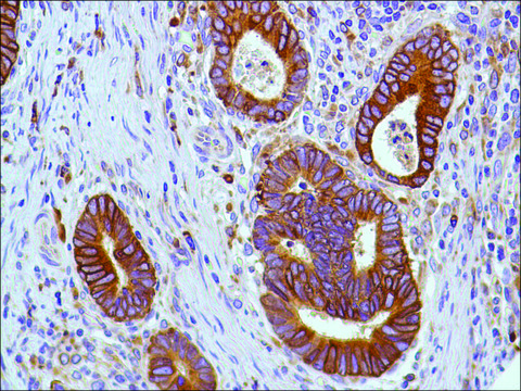 Anti-COX2 antibody, Rabbit monoclonal