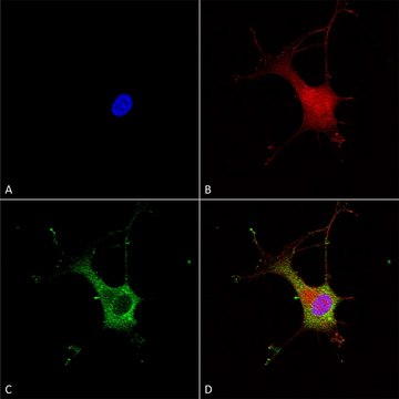Monoclonal Anti-Versican - Fitc antibody