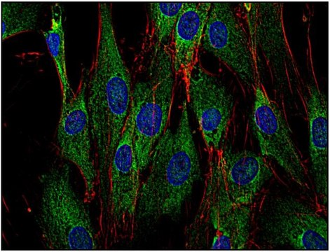 Monoclonal Anti-SOS antibody produced in