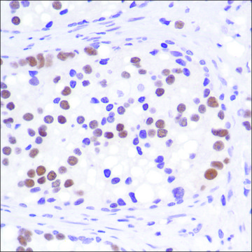 Anti-Androgen Receptor (C-term) antibody, Rabbit