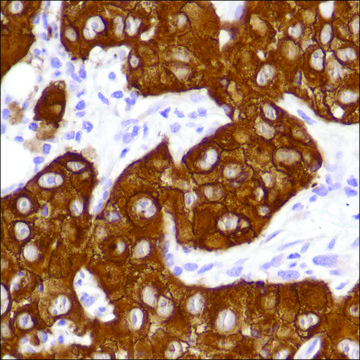 Anti-EGFR antibody, Rabbit monoclonal