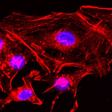 Anti-beta-Actin antibody, Rabbit monoclonal