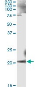 Monoclonal Anti-ANK1 antibody produced in