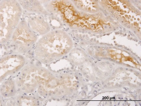 Monoclonal Anti-S100A5 antibody produced in