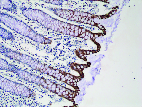 Anti-Cytokeratin-20 antibody, Rabbit Monoclonal