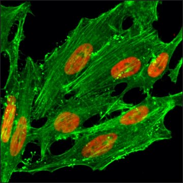 Anti-Acetyl-Histone H2A.Z (Lys7) antibody, Rabbit