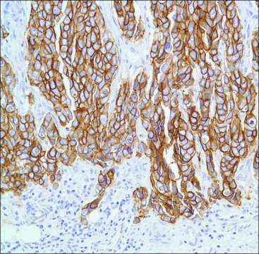 Anti-C-ERBB-2/HER-2 antibody, Rabbit monoclonal