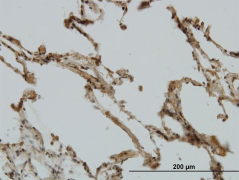 Monoclonal Anti-CRIM1 antibody produced in
