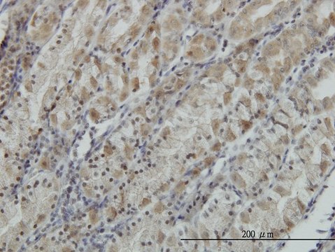Monoclonal Anti-ATP6V0D1 antibody produced in