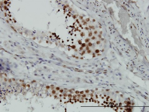 Monoclonal Anti-HMGB2 antibody produced in