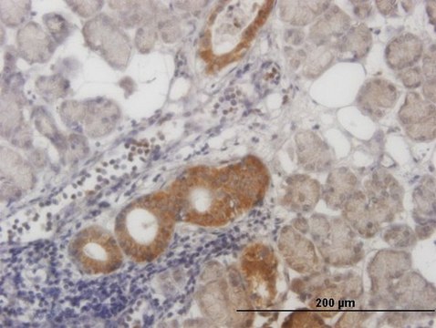 Monoclonal Anti-ALS2CR8 antibody produced in