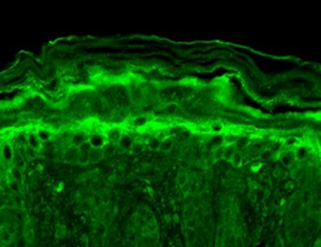 Monoclonal Anti-KCNT1 antibody produced in