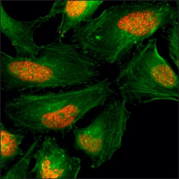 Anti-Histone H2AX antibody, Rabbit monoclonal