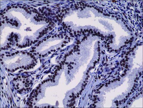 Anti-AR (n-terminal) antibody, Rabbit monoclonal