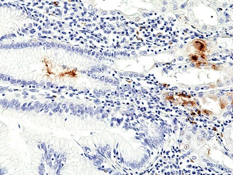 Anti-Helicobacter Pylori (H.Pylori) Rabbit Monoclonal