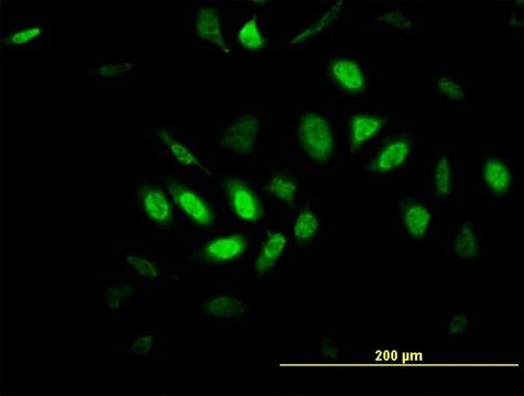 Monoclonal Anti-TFDP3 antibody produced in