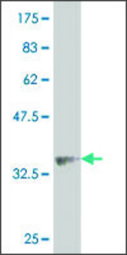 Monoclonal Anti-ALPK2 antibody produced in