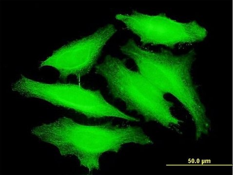 Monoclonal Anti-PAPOLB antibody produced in