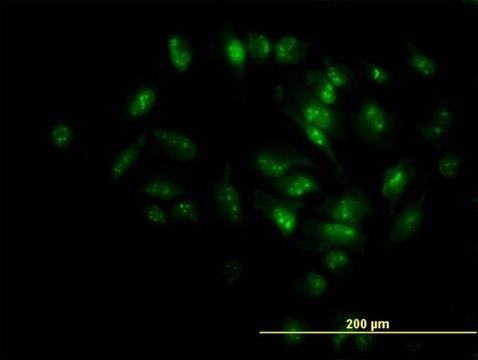 Monoclonal Anti-MPHOSPH10 antibody produced in
