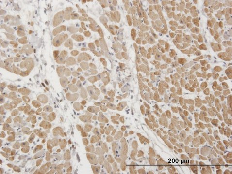 Monoclonal Anti-TNNI3 antibody produced in