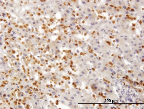 Monoclonal Anti-TARS antibody produced in