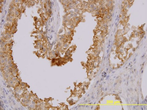 Monoclonal Anti-MARCKSL1 antibody produced in