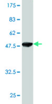 Monoclonal Anti-GUK1 antibody produced in