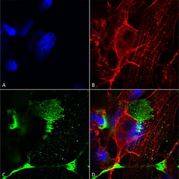 Monoclonal Anti-Tarp antibody produced in