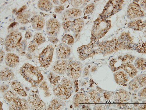 Monoclonal Anti-TPP1 antibody produced in