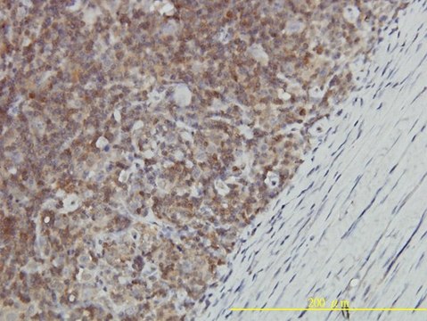 Monoclonal Anti-GALT antibody produced in