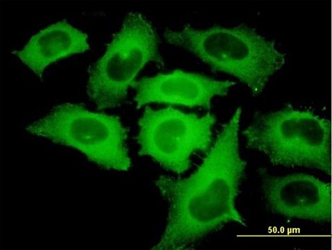 Monoclonal Anti-TIPIN antibody produced in