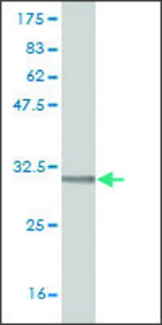 Monoclonal Anti-RCE1 antibody produced in