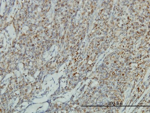 Monoclonal Anti-JUP antibody produced in