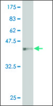 Monoclonal Anti-HEMK2 antibody produced in