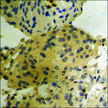Anti-phospho-B-RAF (pSer??²) antibody produced in