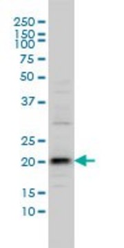 Monoclonal Anti-C20orf102 antibody produced in