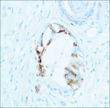 Anti-SPINK1 antibody, Rabbit monoclonal