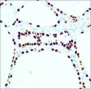 Anti-Thyroid Transcription Factor-1 antibody, Rabbit