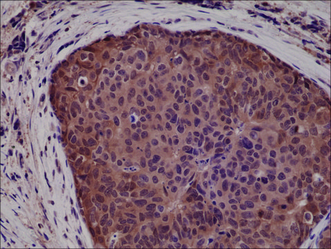 Anti-p38 MAPK antibody, Rabbit monoclonal