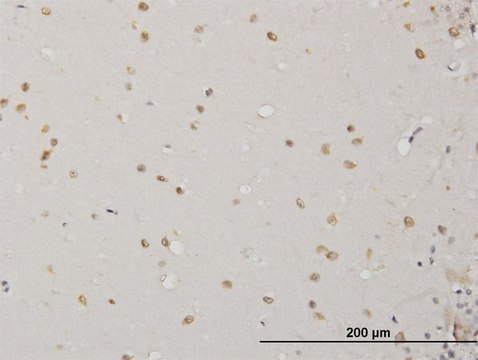 Monoclonal Anti-ABL2 antibody produced in