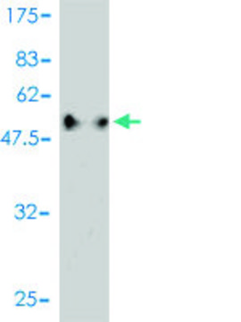 Monoclonal Anti-C1QTNF2 antibody produced in