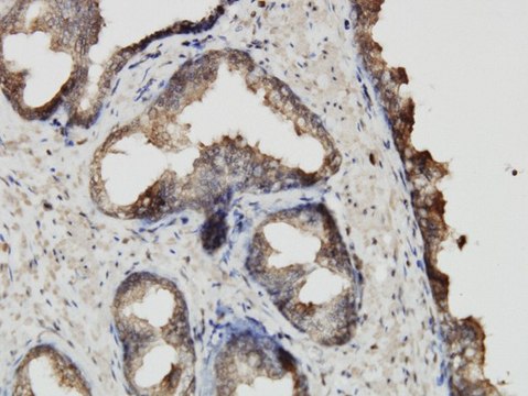 Monoclonal Anti-ABCF2 antibody produced in