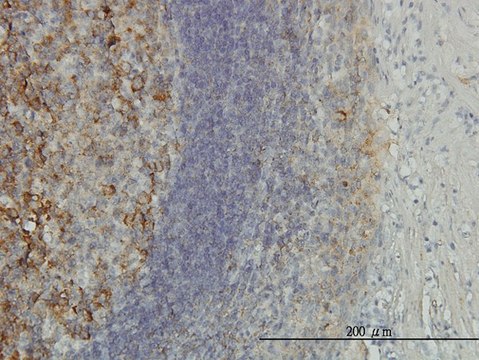 Monoclonal Anti-PSMD10 antibody produced in