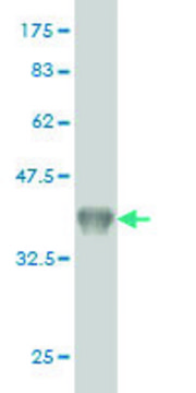 Monoclonal Anti-CYP26B1 antibody produced in