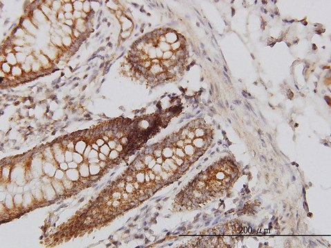 Monoclonal Anti-HIP1 antibody produced in