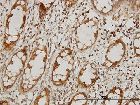 Monoclonal Anti-IKBKAP antibody produced in