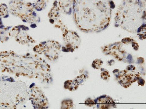 Monoclonal Anti-THUMPD1 antibody produced in